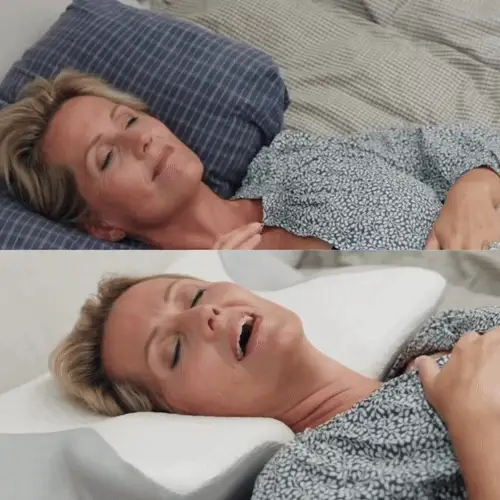 Antes y después con OrthoSleep